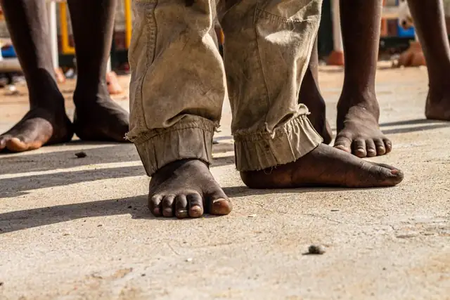 foot — photo