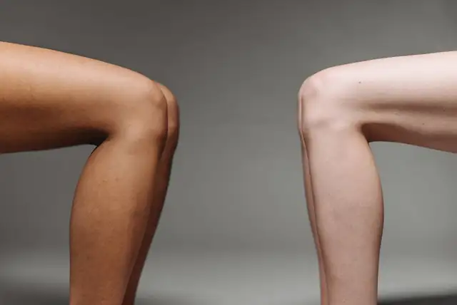 knee — photo